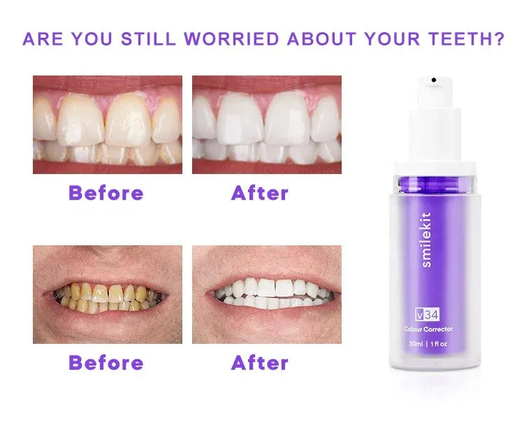 Hismile - Teeth Brightening Serum V34