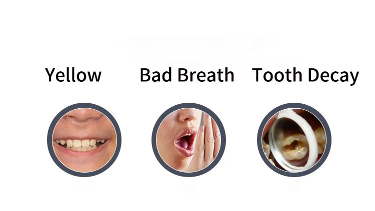360 Degreed U Type Automatic Electric Toothbrush Rechargeable forAdults Ultrasonic Sonic Tooth Brushes Blue Light IPX7Waterproof