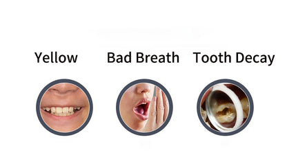 360 Degreed U Type Automatic Electric Toothbrush Rechargeable forAdults Ultrasonic Sonic Tooth Brushes Blue Light IPX7Waterproof