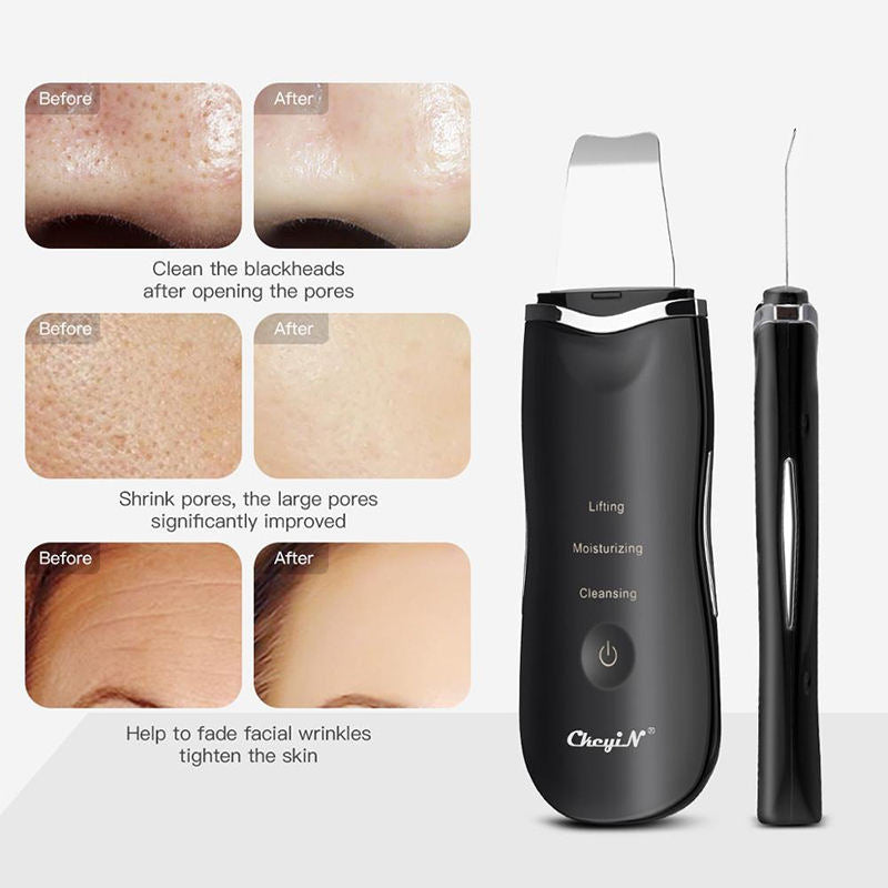 3-in-1 Ultrasonic Facial Skin Scrubber