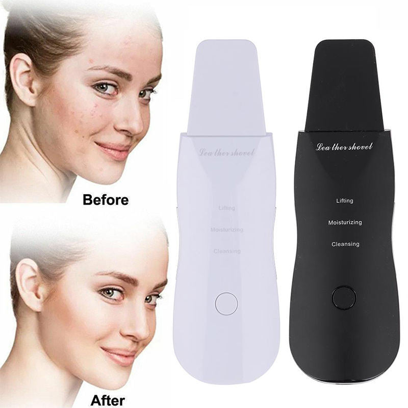 3-in-1 Ultrasonic Facial Skin Scrubber